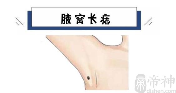 腋下长痣的位置图解图片